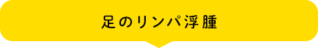 足のリンパ浮腫
